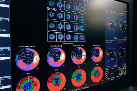 Кировские онкологии имеют возможность провести уникальную диагностику